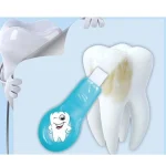 Засіб для відбілювання зубів Teeth Cleaning Kit - Зображення 6