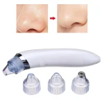 Вакуумний очищувач пор для обличчя Derma Suction - Зображення 2